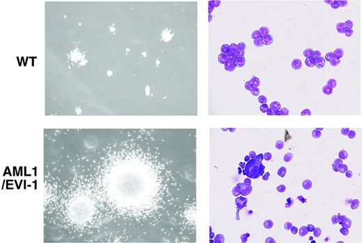 Figure 5. Morphology of serially replated AML1/EVI1/+ hematopoietic colonies. (Left) WT and typical dysplastic multilineage AML1/EVI1/+ colonies after the fourth passage. The size of AML1/EVI1/+ hematopoietic colonies is significantly larger than that of WT colonies. (Right) Wright-Giemsa-stained cytocentrifuge preparations of the WT and AML1/EVI1/+ colony. AML1/EVI1/+ hematopoietic colonies maintain the dysplastic nature. Scales bars equal 300 μm (OL, 100 ×/1.40; OM, × 1000).