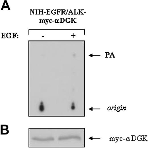 Figure 3. EGF-induced αDGK activation in NIH-EGFR/ALK cells. NIH-EGFR/ALK cell line was transiently transfected with the expression vector pMT2-myc-αDGK according to the calcium-phosphate technique. Cells were serum-starved for 18 hours and then either mock-treated (-) or stimulated (+) for 10 minutes at 37°C with 100 ng/mL EGF and lysed thereafter. Lysates were immunoprecipitates with appropriate concentrations of agarose-conjugated anti-c-myc antibody. (A) Immunocomplexes were subjected to in vitro kinase assay as described in Figure 1. (B) An aliquot of each sample was analyzed by Western blot to control that equal amounts of myc-αDGK were present during in vitro kinase assay.