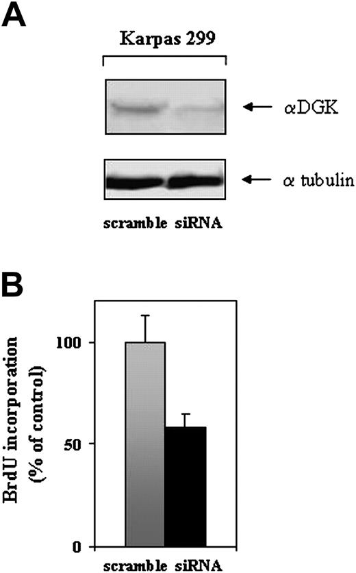 Figure 7. Down-regulation of αDGK by RNA interference on Karpas 299 cell proliferation. (A) siRNA-transfected Karpas 299 cells were lysed 72 hours from transfection, and their αDGK content was assayed by Western blot with anti-αDGK antibodies (top panel). As an internal control, the same blot was reprobed with an anti-α-tubulin antibody without prior stripping (bottom panel). (B) BrdU incorporation of siRNA-transfected Karpas 299, 72 hours following transfection. Results are expressed as percent of control (BrdU incorporation obtained from untransfected cells). Upon our experimental conditions, 60% to 70% of Karpas 299 cells resulted transiently permeabilized, as measured by trypan blue staining immediately after electroporation. The values represent the means ± SD (n = 3).