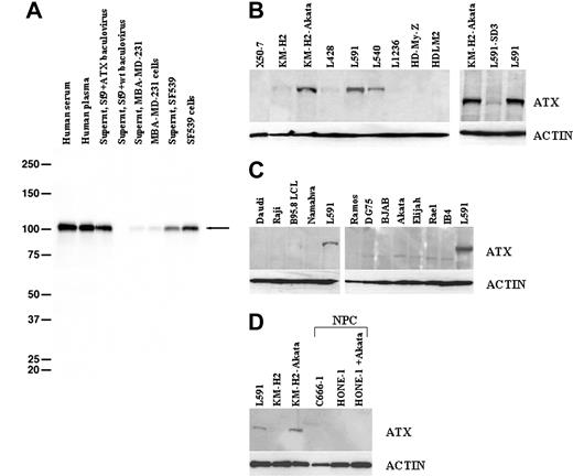 Figure 2. Generation of autotaxin-specific monoclonal antibodies and the specific up-regulation of autotaxin protein by EBV-infection of HL cells. (A) Immunoblotting of sf9 cells infected with autotaxin (ATX)-baculovirus using 2A12 antibody demonstrates strong reactivity, whereas sf9 cells infected with wild-type (wt) baculovirus show no reactivity. Also shown here is reactivity against autotaxin in human serum, human plasma, culture supernatant and cells of breast cancer cell line MBA-MD-231, and supernatant and cells of glioma cell line SF539. (B) Western blotting using 2A12 antibody demonstrates increased autotaxin protein in EBV-infected KM-H2 cells (KM-H2 Akata) compared with uninfected KM-H2 cells (left panel). Most other EBV-negative HL cell lines (L428, L540, L1236, HD-MyZ, HDLM2) expressed lower levels of autotaxin protein. (right panel) Down-regulation of autotaxin protein in L591 cells after the loss of the EBV genome. (C) Autotaxin could not be detected in EBV-negative BL cells (Ramos, DG75, BJAB) or in a number of EBV-positive BL cells, including those displaying a type 1 form of EBV latency (Akata, Rael, Elijah), a type 3 form of EBV latency (Raji, Namalwa), or a Wp-restricted pattern of EBV latency (Daudi) that expresses EBNA1 and the EBNA3 family. BL lines are negative for autotaxin, though there is an unidentified lower molecular weight band in the DG75, BJAB, Akata, Elijah, and Rael BL lines and in the IB4 LCL line. Furthermore, of several lymphoblastoid cells lines (X50-7, B95.8 LCL, IB4), only B95.8 cells expressed detectable levels of autotaxin. (D) NPC cells, including EBV-positive C666-1 and EBV-negative HONE-1 cells, lacked autotaxin protein. HONE-1 cells infected with the same Akata-derived recombinant EBV used to generate EBV-positive KM-H2 cells failed to up-regulate autotaxin expression after infection.