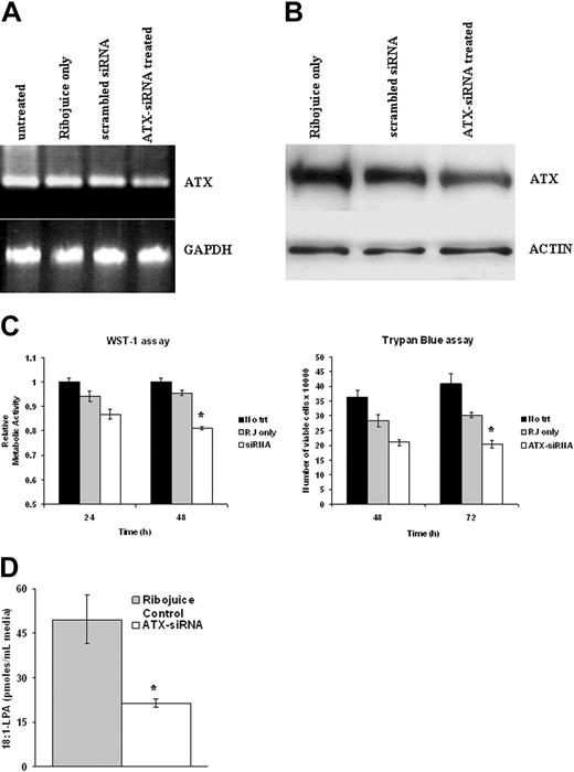 Figure 5. Autotaxin promotes the growth and survival of EBV-infected HL cells. (A) (top left) Semiquantitative RT-PCR analysis of equivalent starting amounts of cDNA (shown here are results of 30 cycles of amplification) from untreated EBV-positive KM-H2 cells or these cells treated for 48 hours with transfection reagent alone (Ribojuice only), Ribojuice plus scrambled siRNA, or autotaxin (ATX)-specific siRNAs. A clear difference in autotaxin mRNA levels between siRNA-transfected and control cells was detectable. (bottom panel) GAPDH mRNA levels were unaffected by these treatments. (B) Immunoblotting demonstrates knockdown of autotaxin protein in EBV-positive KM-H2 cells treated with autotaxin-specific siRNAs compared with controls. (C) Treatment of EBV-infected KM-H2 cells with autotaxin-specific siRNAs resulted in significant reduction in proliferation after 48 hours (top panel) and cell viability after 72 hours (bottom panel) compared with cells treated with transfection reagent alone or with scrambled siRNA (data not shown). RJ indicates ribojuice transfection reagent. (D) Down-regulation of autotaxin expression in EBV-infected KM-H2 cells resulted in reduced generation of LPA from LPC.