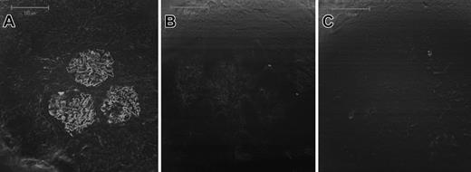 Figure 3. Glomerulonephritis in EAV is pauciimmune. Glomerular Ig deposition was assessed using direct immunofluorescence on 3-μm frozen sections. (A) Linear staining for IgG in a rat with experimental autoimmune glomerulonephritis, a model of antiglomerular basement membrane disease. This serves as a positive control; (B) scanty Ig deposits in a rat with EAV; (C) negative staining in a rat immunized with CFA alone. Images were captured using a confocal microscope, and bars represent 100 μm (× 20).
