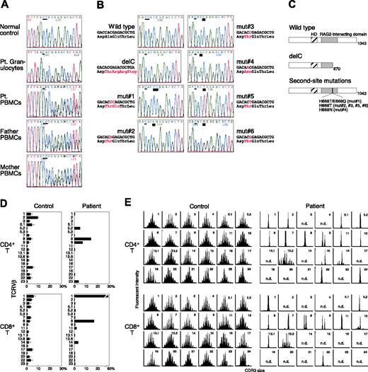 Figure 1. Characterization of RAG1 gene mutations and T-cell receptor (TCR) Vβ repertoire. (A) The RAG1 gene was amplified from DNA extracted from normal PBMCs, the patient's granulocytes and PBMCs, and the parents' PBMCs. Direct sequencing was performed using an automated sequencer. A thin bar shows the position of the delC mutation. Pt indicates patient. (B) Sequence analysis of the same genomic region in subcloned PCR products obtained from the patient's T cells. A thick bar highlights the position of the second-site mutations. (C) Predicted structures of mutated RAG1 molecules. HD indicates homeodomain. (D) Expression profile of TCRVβ subfamilies. Peripheral blood samples were stained with monoclonal antibodies (mAbs) for individual TCRVβ together with anti-CD4 and anti-CD8 mAbs. The percentage of each TCRVβ expression within CD4+ or CD8+ T cells was analyzed by a flow cytometry. (E) CDR3 spectratyping. Each TCRVβ fragment was amplified from cDNA with one of the Vβ-specific primers. The size distribution of PCR products was determined by an automated sequencer and GeneScan software.