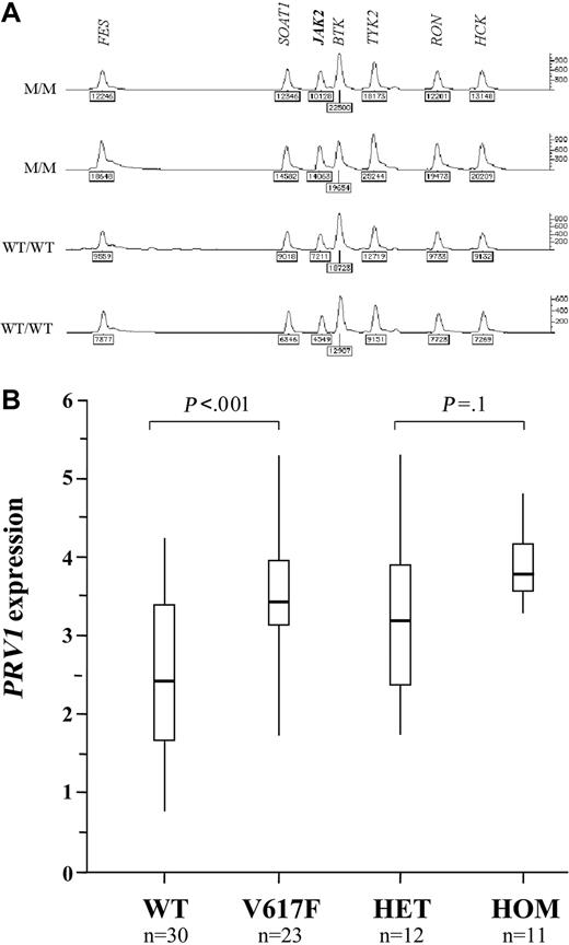 Figure 4. JAK2 copy number and correlation of status with PRV1 expression. (A) Representative results of MLPA analysis to measure JAK2 copy number. The relative peak areas for JAK2 are the same for 2 homozygous V617F cases with 9p LOH (M/M) and 2 healthy controls (WT/WT), indicating the presence of 2 copies of JAK2. The second case is male and shows a reduced peak height for the X-linked gene BTK compared with the 3 other cases, all of which were female. (B) PRV1 mRNA levels (log10deltadeltaCtPRV1/ABL) determined by real-time PCR in 30 MPD patients with normal JAK2 (WT) and 23 MPD patients with the V617F mutation. These 23 patients are also shown split into the 12 heterozygous (HET) and 11 homozygous (HOM) cases. Vertical lines indicate the range of results, open boxes indicate the interquartile range, and thick horizontal lines indicate median values.