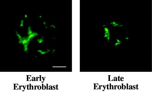 Figure 4. Distribution of nuclear matrix protein NuMA in erythroid progenitors. Early and late mouse erythroblasts from freshly harvested bone marrow labeled with anti-NuMA (green) show similar staining patterns, demonstrating that NuMA does not undergo detectable redistribution during later phases of terminal differentiation. Bar is 2.5 μm.