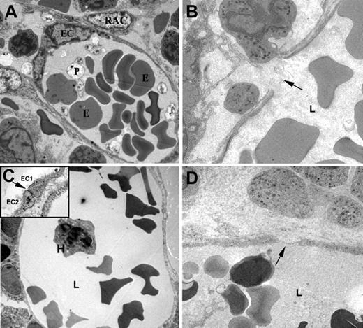Figure 1. Disruption of human and murine BM sinusoids after irradiation and chemotherapy. Transmission electron microscope images of murine (A,B) and human (C,D) BM sinusoids. Elongated endothelial cells (EC) form the luminal layer of the sinusoid, surrounded by discontinuous cytoplasmic protrusions of reticular adventitial cells (RAC). Erythrocytes (E), platelets (P), and nucleated hematopoietic cell (H) are seen within the sinusoid lumen (L). The continuous murine endothelial cell layer is damaged after irradiation, resulting in gap formation due to rupture of the EC cytoplasm (B, arrow). Tight junctions between adjacent EC (C inset, arrow) are frequently seen in normal human sinusoids (C). Chemotherapy and irradiation cause significant narrowing of EC cytoplasm (D, arrow) together with rupture of the cell membrane and EC necrotic appearance (D). Images were acquired with a Techai-12 microscope (Philips, Eindhoven, The Netherlands) and Megaview III (Soft Imaging System, Munster, Germany). Samples were counterstained in uranyl acetate and lead citrate. Original magnification, × 3700 (panels A, C, D), × 5900 (panel B), and × 37 000 (panel C, inset).