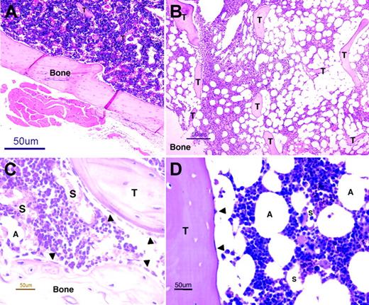 Figure 2. BM architecture. Light microscopy images of murine (panels A,C) and human (panels B,D) BM sections stained with hematoxylin and eosin. Extensive invasions of spongy bones (trabeculae, T) and many fat cells (adipocytes, A), residing between the hematopoietic niches, characterize human BM (B) and distinguish it from the murine BM (A). Murine (C) and human (D) BM contains many small blood vessels (sinusoids, S), which are the site where progenitors home to the BM and where maturing cells and erythrocytes egress to the circulation (B). A monolayer of immature osteoblasts, which lines the bone and the trabeculae, defines the endosteum region (arrowheads, panels C,D), wherein hematopoietic stem cells reside. Images were acquired using an Eclipse E800 microscope (Nikon, Tokyo, Japan) and a Nikon DXM1200 using Nikon ACT-1 software. For panels A and B, objective × 4/15.7 NA was used (original magnification, × 40); for panels C and D, objective × 40/0.14 NA was used (original magnification, × 400).
