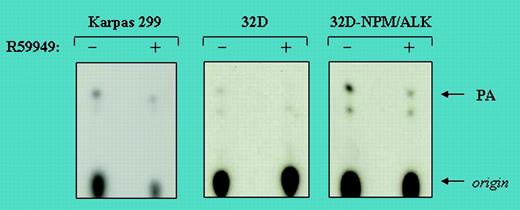 α-DGK activity in NPM/ALK-positive total cell lysates in the presence (+) or absence (-) of the DGK inhibitor R59949. See the complete figure in the article beginning on page 2175.
