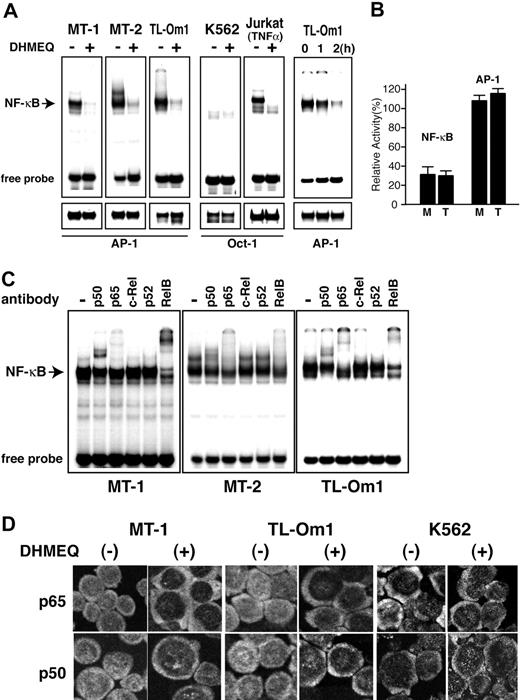 Figure 1. DHMEQ inhibits constitutive NF-κB activity in HTLV-1-transformed and ATL-derived cell lines. (A) EMSA of NF-κB. Inhibition of constitutive NF-κB binding activity by DHMEQ in HTLV-1-transformed and ATL-derived cell lines (left 3 panels). A myeloid leukemia cell line K562 without HTLV-1 infection was used as a control. Cells were cultured with or without 10 μg/mL DHMEQ for 16 hours. Nuclear extracts from Jurkat cells treated with TNF-α served as a control. Upper panels show inhibition of NF-κB binding activity by DHMEQ. Lower panels show results of EMSA with control probes, AP-1 and OCT1. The OCT1 probe was used for HTLV-1-uninfected cells that do not show constitutive activation of AP-1. (B) Inhibition of NF-κB transcription activities in ATL-derived cell lines by DHMEQ. Relative levels of luciferase activities are shown in percentages compared with the levels of untreated cells. M indicates MT-1 cells; T, TL-Om1 cells; NF-κB, NF-κB-driven luciferase construct; AP-1, AP-1-driven luciferase construct. Renilla luciferase vector (pRL-TK) was used to standardize the transfection efficiency. (C) Supershift analysis of the NF-κB components in HTLV-1-transformed and ATL-derived cell lines. Antibodies used are indicated on top. The position of a shifted band corresponding to NF-κB is indicated on the left. (D) Inhibition of nuclear translocation of NF-κB by DHMEQ. Representative results of confocal immunofluorescence analysis using antibodies against NF-κB p65 or NF-κB p50. Original magnification ×600. Images captured with a60×/1.4 objective lens.