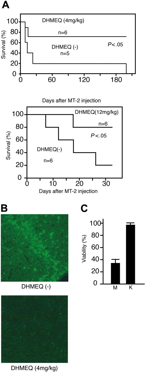 Figure 5. DHMEQ can rescue SCID mice inoculated with MT-2 cells. (A) Survival curves of the SCID mice injected with MT-2 cells. DHMEQ was used at a dose of 4 mg or 12 mg/kg body weight. The differences are statistically significant (both P < .05 by Cox-Mantel test). (B) Reduction of MT-2 cells in the peritoneal mass after DHMEQ treatment. MT-2 cells were detected by immunohistochemistry using anti-p19 antibody. Original magnification ×100. Objective lens, 10×/0.4. (C) Effects of DHMEQ on MT-2 cells. DHMEQ cytotoxicity on MT-2 cells. Cells were treated with 10 μg/mL DHMEQ for 48 hours, and viabilities were studied by MTT assay. K562 cells were used as a control. Data represent the mean ± SD of 3 independent experiments. M indicates MT-2; K, K562.