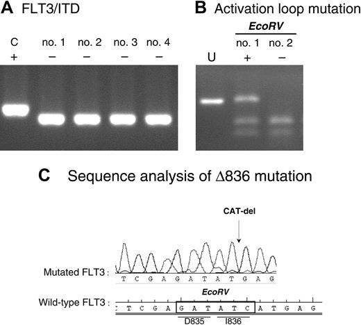 Figure 3. FLT3-activating mutations in infant MLL. (A) ITD of the JM domain of FLT3 in the MV4-11 cell line (C indicates positive control) and 4 examples of infant MLL patients negative for FLT3/ITDs as determined by PCR. (B) Amplified PCR product covering the EcoRV site within the activation loop of FLT3, undigested (U) and digested in both a patient positive (+) and negative (-) for this type of mutation. (C) Sequence analysis of the activation loop mutation found in 1 of 36 patients tested.
