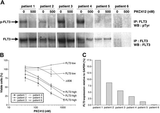 Figure 4. Relation between high-level FLT3 expression, FLT3 activation, and in vitro sensitivity to PKC412. (A) Immunoprecipitation (IP) analysis of FLT3 in primary infant MLL cells carrying wild-type (patient nos. 1-3 and 5) or mutated (patient no. 4) FLT3, cultured for 4 hours in the absence and presence of 500 nM PCK412. Patient no. 6 represents a noninfant ALL patient. To determine the phosphotyrosine (pTyr) content of FLT3, immunoblots were probed with antiphosphotyrosine (4G10) and with anti-FLT3 to assess FLT3 loading. (B) MTT dose-response curves show the mean cytotoxic response to PKC412 for the individual patients. Error bars represent SEM of duplicate wells. (C) Representation of the FLT3 expression levels for the individual patients. WB indicates Western blot.