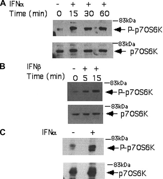 Figure 1. Type I IFN-dependent phosphorylation of the p70 S6 kinase in BCR-ABL-expressing cells. (A) KT-1 cells were treated with IFNα for different time points, as indicated. Equal amounts of total cell lysates were analyzed by SDS-PAGE and immunoblotted with an antibody against the phosphorylated/activated form of the p70 S6 kinase on threonine 421 and serine 424 (top panel). The same blot was then stripped and reprobed with an anti-p70 S6 kinase antibody, to control for protein loading (bottom panel). (B) Similar experiment to the one shown in panel A, except that IFNβ was used instead of IFNα. (C) Granulocytes isolated from the peripheral blood of a patient with CML were incubated with IFNα for 15 minutes. Top panel shows immunoblotting of total cell lysates with an anti-phospho-Thr421/Ser-424 p70 S6 kinase antibody. Bottom panel shows reprobing of the same blot with an anti-p70 S6K antibody, to control for protein loading.