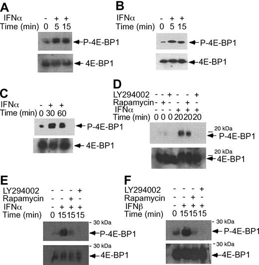 Figure 4. IFNα-dependent phosphorylation of 4E-BP1 repressor of mRNA translation in KT-1 cells. (A) KT-1 cells were treated with IFNα for different times, as indicated. Top panel shows an immunoblot with an antibody against phosphorylated 4E-BP1 on Thr 37/46. Bottom panel shows reprobing the same blot with an anti-4E-BP1 antibody. (B) Similar experiment to the one shown in panel B, except that immunoblotting was first performed using an antibody against the phosphorylated form of 4E-BP1 on Thr 70. (C) Similar experiment to the one shown in panel B, except that the cells were incubated for longer times with IFNα, as indicated. (D) KT-1 cells were preincubated with LY294 002 (50 μM) or rapamycin (20 nM) for 30 minutes and were subsequently treated with IFNα, as indicated. Top panel shows an immunoblot with an antibody against phosphorylated 4E-BP1 on Thr 37/46. Bottom panel shows reprobing of the same blot with an anti-4E-BP1 antibody. (E) KT-1 cells were pretreated with LY294 002 (50 μM) or rapamycin (20 nM) for 30 minutes and were subsequently incubated with IFNα, as indicated. Top panel shows an immunoblot with an antibody against phosphorylated 4E-BP1 on Thr 70. Bottom panel shows reprobing of the same blot with an anti-4E-BP1 antibody. (F) Similar experiment to the one shown in panel E, except that IFNβ was used instead of IFNα.