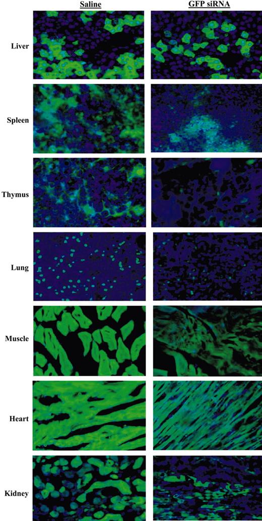 Figure 1. Tissue distribution and the ability of hydrodynamically delivered GFP siRNA to silence GFP expression in GFP-transgenic mice, seen at 600 × magnification. Suppression of green fluorescent protein was seen in the liver, spleen, thymus, lung, muscle, heart, kidney (shown), brain, and Peyer patches (not shown). The qualitative change in GFP intensity and the overall number of fluorescing cells per field was made by an investigator blinded to the sample identity.