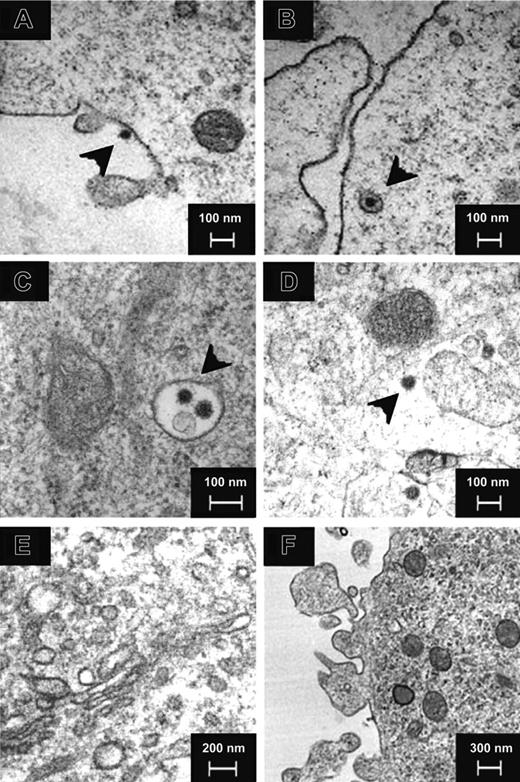 Figure 1. Electron microscopy of SARS-CoV–infected human DCs. Negative-contrast thin-section transmission electron micrograph of SARS-CoV–infected human DCs showed virus (black arrowheads) binding (A) and uptake (B) at 0 hours after infection. At 6 hours, 12 hours, and 24 hours after infection, virus particles were detected in endosomes (C) and cytoplasm (D) but not in the Golgi apparatus (E). No virus budding was observed (F) in all cells examined. Images are representative of SARS-CoV–infected human DCs from 3 independent adult or CB donors.