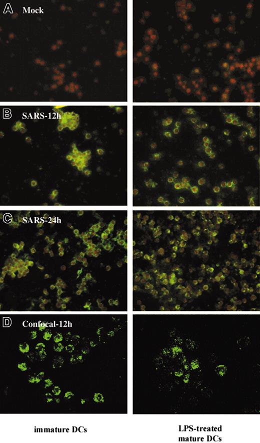 Figure 2. Immunofluorescence assay for SARS-CoV detection in human DCs. Mock-infected human DCs were included as a control (A). Positive immunofluorescence staining was detected in human immature and mature DCs at 12 hours (B) and 24 hours (C) after infection with SARS-CoV (MOI = 1). Confocal microscopy showed positive staining in the cytoplasm of DCs (D). Images are representative of immature and mature DCs from 11 independent adult or CB donors.
