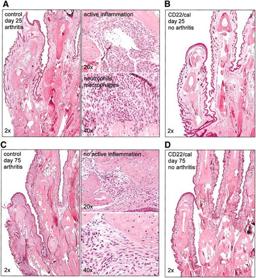 Figure 5. B-cell depletion with CD22/cal inhibits the development of histologic CIA. Mice (n = 10/group) were immunized on day 0 with collagen II in CFA and injected on days 5 and 10 with PBS or CD22/cal. Paws were collected on days 25 or 75 for histologic evaluation. (A) Histopathology of hematoxylin and eosin-stained joints of front paws of control PBS mice collected on day 25. The paws were infiltrated by neutrophils and macrophages consistent with active inflammation. (B) Histopathology of joints of front paws of CD22/cal-treated mice (collected on day 25) showing normal joint architecture. Joint histopathology of (C) control and (D) of B-cell-depleted mice on day 75 after immunization with collagen II. Paws from control mice had remodeling and destruction of the joints consistent with chronic arthritis; paws from B-cell-eted mice had normal joints.