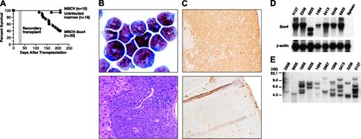 Figure 1. Myeloid leukemia developed in mice that received transplanted MSCV-Sox4-infected bone marrow cells. (A) Survival curve of lethally irradiated mice that received transplanted MSCV-Sox4-infected marrow, uninfected marrow, or empty MSCV-infected marrow. The area shaded in gray represents the survival of secondary transplant recipient mice (n = 8) that received leukemia cells from a primary recipient. (B) (top) Wright-Giemsa staining of representative leukemic bone marrow. (bottom) Hematoxylin and eosin staining of a representative liver section showing leukemia-cell infiltration. Original magnifications, × 400 (left) and × 100 (bottom). (C) Normal (top) and leukemic (bottom) spleens stained with anti-MPO antibody. Original magnification, × 100. (D) Northern blot analysis of Sox4 expression in 7 myeloid leukemias induced by MSCV-Sox4 infection or normal spleen RNA. β-Actin was included to control for RNA loading. The Sox4 transcript expressed in leukemia 0935 was smaller than expected, suggesting a rearrangement in the MSCV-Sox4 virus present in this leukemia. (E) Southern blotting of leukemic spleen DNA using an MSCV-specific probe. Samples were digested with HindIII, which cuts once in the viral construct. Each band represents a separate Sox4 viral integration.