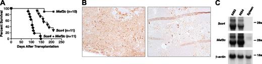 Figure 4. Deregulated Mef2c expression accelerates the development of Sox4-induced leukemia. (A) Survival curve of lethally irradiated mice receiving MSCV-Mef2c-infected, MSCV-Sox4-infected, or double-infected bone marrow cells. (B) MPO staining of a representative leukemic spleen from an animal receiving double-transduced cells (top) or normal spleen (bottom). Original magnification, 100 ×. (C) Northern blot analysis of total RNA prepared from the spleens of 2 leukemic mice receiving double-infected bone marrow and normal mice using probes specific for Sox4 and Mef2c. β-Actin was used as a control for RNA loading.