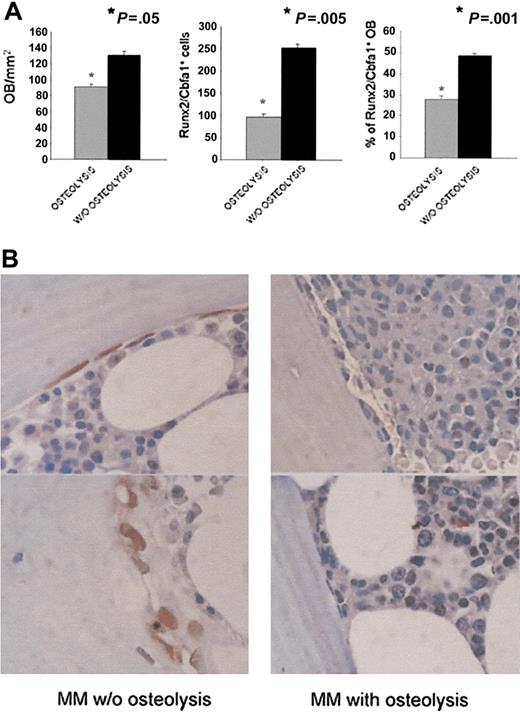 Figure 8. Runx2/Cbfa1 immunostaining in BM biopsies of patients with MM. (A) Histomorphometry and Runx2/Cbfa1 immunostaining performed on BM biopsies of 40 patients with MM who either had bone lesions or did not have skeletal involvement as described in “Patients, materials, and methods.” Graphs and bars represent the mean ± SD of the number of osteoblasts (OBs)/mm2, the number of total Runx2/Cbfa1 positive stromal/osteoblastic cells, and the % of Runx2/Cbfa1-positive OBs. (B) Runx2/Cbfa1 immunostaining performed in a trabecula of 2 representative patients with MM who did or did not have bone lesions (original magnification, × 1000). See “Immunohistochemistry” for image acquisition details.