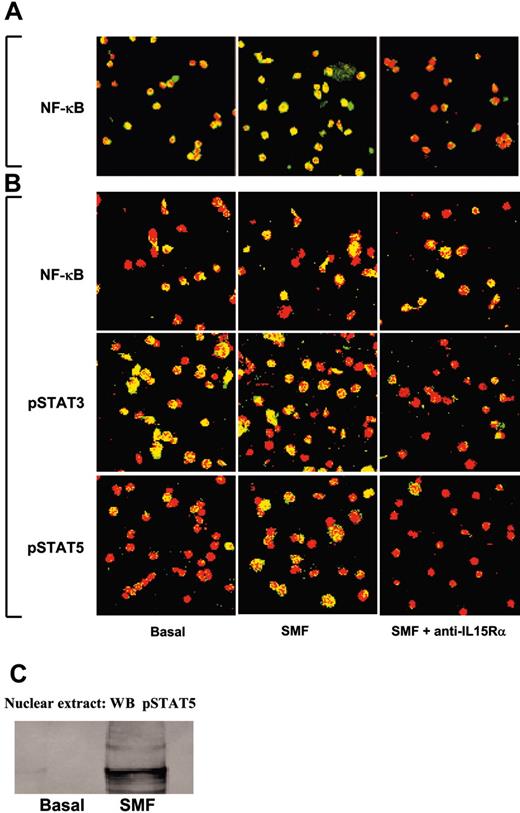 Figure 3. Confocal microscopy analysis of NF-κB p65, STAT3, and STAT5 nuclear localization in unprimed and pro-NK-committed CB progenitors induced by SMFmb-IL-15. (A) CB hematopoietic progenitors were analyzed soon after immunopurification (day 0, panel A) or after 5 days in the presence of r-SCF/r-Flt3-L (day 5, panel B). Overlay pictures (original magnification, ×63). Left panels show basal conditions; central panels, 30 minutes of contact with SMF at 37°C; and right panels, 60 minutes of preincubation with 10 μg/mL neutralizing anti-IL-15Rα mAbs, followed by 30 minutes with SMF. CB progenitors were labeled with anti-NF-κB p65, anti-pSTAT3, and anti-pSTAT5 antibodies, and then incubated with Alexa Fluor488-GARa (goat antirabbit) antibody (green staining). Propidium iodide stained the nuclei red. Nuclear p65, STAT3, and STAT5 are indicated by nuclear yellow staining. As negative controls, cells were incubated with only the second reagent and propidium iodide. These data are representative of 3 different experiments. Images were obtained with a 63 ×/1.30 objective lens. (C) Western blot analysis of STAT5 phosphorylation using anti-pSTAT5 Ab in nuclear extracts of 5-day-old CB pro-NK progenitors stimulated or not by 45 minutes of contact with SMFmb-IL-15.