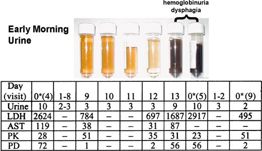 Figure 4. Relationship between complement inhibition with eculizumab and various hemolytic parameters and symptoms during a transient breakthrough in serum-complement activity. Urine color, symptoms, biochemical parameters of hemolysis, PK, and PD were assessed during a 14-day eculizumab-dosing interval in a patient with a transient breakthrough in serum hemolytic activity. Eculizumab was administered on day 0 after assay samples were collected. A urine colorimetric score of 6 or greater was considered abnormal (hemoglobinuria). Levels of the hemolytic markers LDH and AST are shown (IU/L). Eculizumab serum concentrations (PK, μg/mL) of ≥ 35 μg/mL were sufficient to maintain a serum hemolytic activity (PD, % serum hemolytic activity) of ≤ 20%, a value known to represent complete complement blockade. The eculizumab-dosing interval was reduced to 12 days between visits 5 and 9. Urine row presents colorimetric scores. — indicates not determined. *Dose of eculizumab.