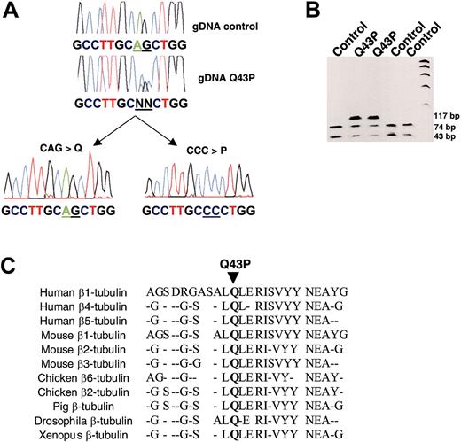 Figure 1. Mutational analysis of β1-tubulin. (A) Sequencing of β1-tubulin cDNA from a control subject and a patient with thrombocytopenia (Q43P). A double base-pair substitution, AG to CC, was found at nucleotide positions 130 and 131 of the β1-tubulin gene, as could easily be detected in subcloned β1-tubulin reverse transcriptase (RT)-PCR fragments from this patient. (B) The region encompassing exon 2 (117-bp PCR product) was amplified from genomic DNA before allele genotyping using PvuII digestion (74 and 43 bp) and analysis by agarose gel electrophoresis. The CAG-to-CCC double substitution (Q43P) leads to a loss of PvuII digestion. (C) This mutation results in a replacement of the highly conserved Gln at position 43 for Pro.