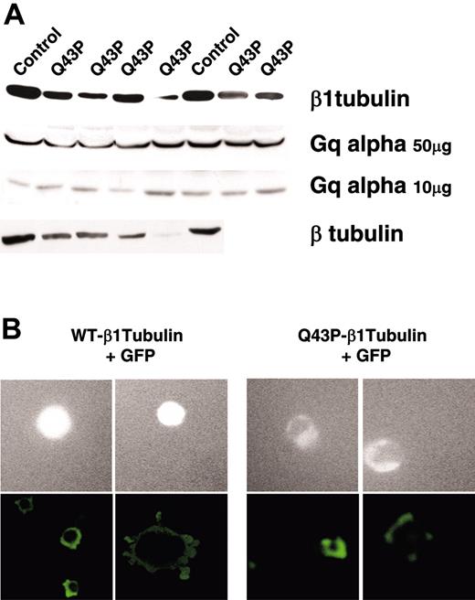 Figure 3. β1-tubulin protein expression. (A) Immunoblot analysis of β1-tubulin, β-tubulin, and Gq alpha in the total platelet protein fractions (10 or 50 μg) from healthy controls and 4 to 6 unrelated heterozygous Q43P carriers. Gq alpha serves as a loading control. (B) Contrast microscopy of GPF-tagged β1-tubulin in MEG01 megakaryocytic cells transfected with pEGFP-WT-β1-tubulin or pEGFP-Q43P-β1-tubulin (top 4 rows). Immunofluorescence analysis of transfected MEG01 cells on Horm collagen (bottom left panels) or fibrinogen (bottom right panels). Original magnification, × 20.