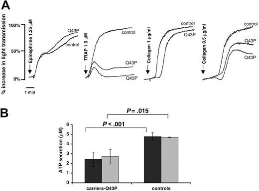 Figure 4. Platelet aggregation and secretion. (A) Platelet aggregations in citrated PRP from a control subject and 2 Q43P carriers (carriers 2 and 4) are shown with the indicated agonists and concentrations. Aggregations were performed in 5 unrelated carriers on separate occasions with similar results. (B) Platelet ATP secretion after stimulation of citrated PRP with ADP (5 μM, ▪) or collagen (2 μg/mL, ▦) shows a significantly decreased response in the 6 unrelated Q43P carriers compared with 6 healthy controls.