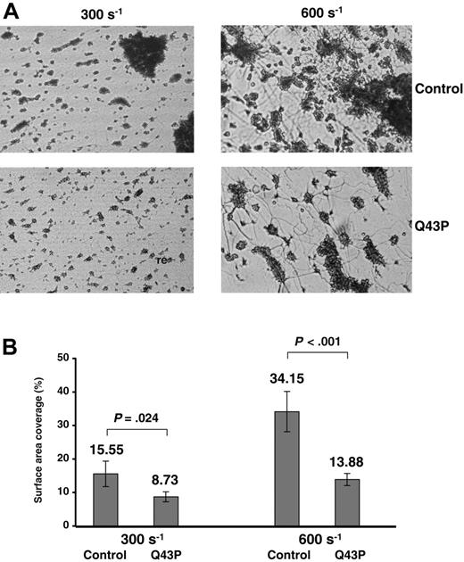 Figure 5. Platelet adhesion studies. Platelet adhesion to Horm collagen was studied by flow chamber experiments. Heparinized blood from 3 unrelated Q43P carriers (carriers 1, 5, and 6) and 2 control subjects was perfused over collagen-coated slides at shear rates of 300 and 600 s-1. (A) The figures represent images of a portion of the flow chamber for platelets derived from the indicated subjects and show that the platelet aggregates are smaller in the Q43P carriers. Original magnification, × 200. (B) Mean surface area coverage (percentage) of platelets at shear rates of 300 and 600 s-1 after a perfusion time of 5 minutes for the indicated subjects. The statistical significance of observed differences between the 2 groups is indicated above each pair of bars. Error bars indicate mean ± standard deviation (SD).