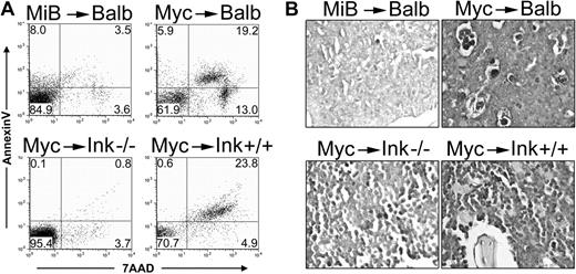 Figure 5. Myc-induced myeloid leukemias are characterized by increased bone marrow apoptosis. (A) Apoptotic cells in the bone marrow of moribund leukemic mice were assessed by annexin V and 7-AAD staining and followed by flow cytometry. Numbers represent the percentage of events in each quadrant. MSCV-Myc+Bcl2 (MiB)/Balb/c showed 15% annexin V- and/or 7-AAD-positive cells compared with 38% dying cells in matched stain mice expressing Myc but not Bcl-2 (Myc/Balb, top panels). Bone marrow from leukemic Myc/Ink4a-/- mice are 5% apoptotic compared with 29% apoptotic cells in the marrow of wild-type mice expressing Myc (Myc/Ink4a+/+, bottom panels). A representative of 3 independent analyses is shown. (B) Bone marrow sections from moribund leukemic mice were prepared and stained with terminal deoxynucleotidyl transferase-mediated dUTP nick end labeling (TUNEL). Myc induces AML and apoptosis, whereas Myc+Bcl2 induces AML and ALL. Expressing Myc in bone marrow with targeted disruption of the Ink4a gene (Ink4a-/-) yields results similar to Myc+Bcl2. MiB, MSCV-Myc+Bcl2; Myc, MSCV-Myc; Ink, Ink4a.