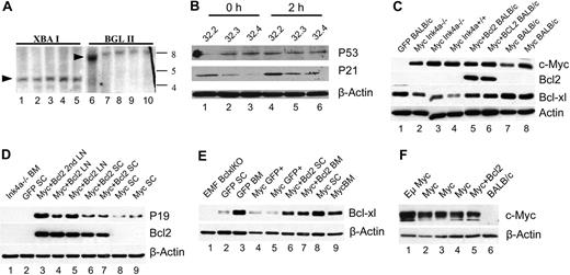 Figure 7. MSCV-Myc leukemias contain intact Arf-p53 pathways. (A) Germline DNA from spleens of leukemic mice was analyzed by Southern hybridization using an Ink4a exon 1β probe. Lanes 1 and 6 are Balb/c control mice and demonstrate the germline configuration of the locus. Arrowheads indicate size of germline fragments. Lanes 2 to 5 and 7 to 10 are MSCV-Myc spleen cells. Lanes 1 to 5 are spleen genomic DNA samples digested with XbaI and lanes 6 to 10 are digested with BglII. The band in lane 6 is due to inadvertent DNA overloading noted on ethidium-stained gel (data not shown). In all leukemias examined, the Ink4 locus was found to be in germline configuration. (B) Western blot analysis of p53 protein and the p53 target p21 in isolated leukemia cells before and after γ-irradiation. Leukemia cells were purified from spleens of moribund MSCV-Myc mice by FACS sorting on GFP and forward/side scatter profiles. Lysates were isolated at time zero (lanes 1-3) and from parallel cell aliquots 2 hours after irradiation with 500 Gy (lanes 4-6). All lanes have detectable p53 and the 2-hour samples reveal increased p21 levels, consistent with expected up-regulation by intact p53 response. β-actin levels indicated equivalent protein loading in all lanes. (C) Western analysis of proteins from tissues of leukemic and control animals that underwent transplantation. Myc protein is expressed in all MSCV-Myc and MSCV-Myc+Bcl2 mice. Bcl-2 is only expressed in MSCV-Myc+Bcl2 mice. Bcl-XL is expressed in normal bone marrow as well as unfractionated leukemia samples due to normal cell contamination (see panel E). (D) Western analysis of p19Arf and Bcl-2 proteins in animals that underwent transplantation. Arf is expressed in all tumors analyzed. Arf-null mouse embryonic fibroblasts (MEFs) are shown as negative control. Bcl-2 is expressed only in MSCV-Myc+Bcl2 samples. (E) Comparison of Bcl-XL protein levels in unfractionated and purified tumor-cell populations. Unfractionated tumor tissues show abundant Bcl-XL protein due to contamination with normal cells. Bcl-XL levels in purified leukemia cells are much lower (see panel B). (F) Comparison of c-Myc expression in Eμ-Myc lymphoma and MSCV-Myc leukemia. Whole-cell lysates were prepared from tumor-bearing lymph nodes from an Eμ-Myc mouse, and spleen cells from MSCV-Myc (Myc), MSCV-Myc+Bcl2 (Myc+Bcl2), and normal Balb/c control (BALB/c) mice. Expression levels appear equivalent in samples from retroviral and transgenic models.