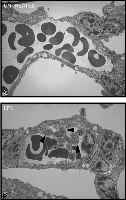 Figure 6. Transmission electron micrographs of pulmonary interstitium taken at a magnification of × 3500. (A) Representative electron micrograph of untreated mice. This section shows a small arteriole/venule in the interstitium containing numerous red blood cells and plasma. Neither platelets nor neutrophils were apparent. Occasionally, solitary platelets were seen in other sections. (B) Representative electron micrograph of LPS-treated wild-type mice for 4 hours. This section shows, in addition to red blood cells and plasma, numerous platelets (arrowheads), many of which are adherent to the endothelial surface and to each other. There is no evidence of fibrin thrombus formation, and the platelets are not degranulating.