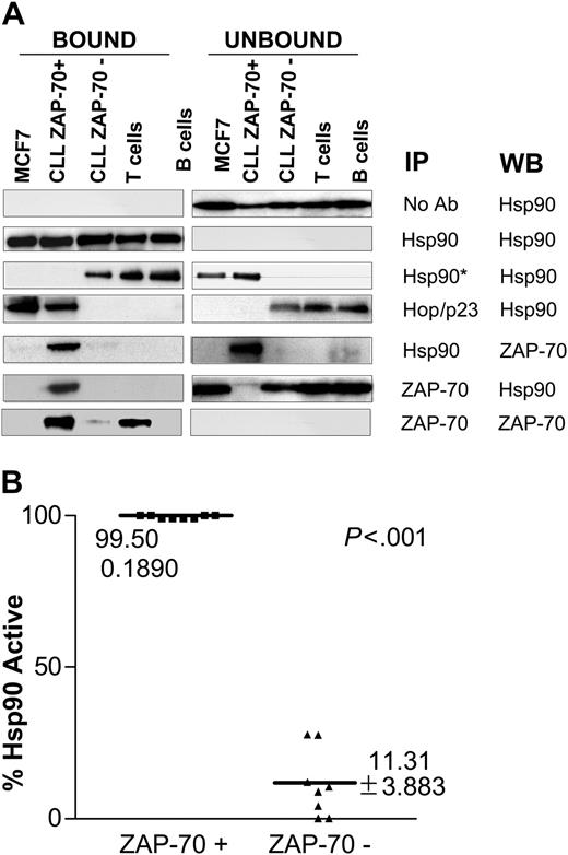 Figure 2. ZAP-70 physically associates with activated Hsp90 in CLL cells. (A) Protein lysates from different cell types including ZAP-70+ and ZAP-70-CLL cells, normal T and B cells, and the breast cancer cell line MCF-7 were immunoprecipitated with the indicated antibodies, including Hsp90*, which is an antibody that recognizes the uncomplexed form of Hsp90. The bound and unbound immunoprecipitated products were probed by immunoblot using the antibodies indicated in the WB column. (B) Immunoprecipitation was used to assess the level of expression of complexed (activated) and uncomplexed (nonactivated) Hsp90 in different CLL samples (8 ZAP-70+ CLL and 8 ZAP-70-CLL). The figure shows the percentage of activated Hsp90 for each sample. This percentage was calculated after analyzing the digitalized composite ratio of immunoblot signal for Hsp90 uncomplexed and total Hsp90 using the following formula: % Hsp90active = 1-(Hsp90*/Hsp90total) × 100.