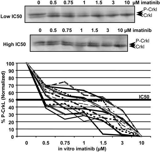 Figure 2. Western blot titrations demonstrating the decrease in percentage of p-Crkl at increasing concentrations of imatinib in 2 patients with varying IC50imatinib. The top blot represents phosphorylated Crkl; the bottom blot, the nonphosphorylated Crkl. The graph demonstrates the variation in IC50imatinib in 15 patients enrolled to the TIDEL study.