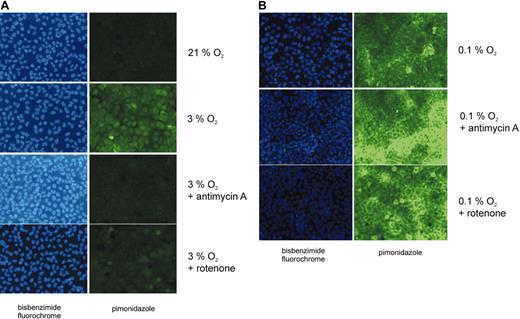Figure 5. Cellular hypoxia assessed by pimonidazole staining. Human osteosarcoma cells (U2OS) were grown in oxygen-impermeable dishes and incubated in the absence or in the presence of either antimycin A (1 μg/mL) or rotenone (1 μM) in hypoxia for 4 hours. Normoxic, untreated cells served as a control. Intracellular pimonidazole complexes, which are formed under hypoxic conditions (pO2 less than 10 mm Hg), were detected by fluorescence microscopy using an FITC-labeled monoclonal antibody. Pimonidazole was applied to the cells for 45 minutes. Cell nuclei were visualized by bisbenzimide staining. Cells were exposed to (A) intermediate hypoxia (3% O2) or (B) to almost anoxic conditions (0.1% O2).