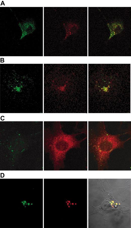 Figure 5. Confocal microscopy of the uptake of Hx-heme and receptor-binding α2-macroglobulin in COS-1 cells. (A) Immunostaining of cells incubated 2 minutes at 37°C with Alexa 488-labeled Hx-heme (green color) and monoclonal rhodamine-labeled anti-LRP/CD91 antibody (red color). Notice the colocalization of the 2 fluorochromes. (B) Cells incubated 2 minutes at 37°C with Alexa 488-labeled Hx-heme (green color) and immunostaining for EEA1 using Alexa 594-labeled secondary antibody (red color). (C) Cells incubated for 60 minutes with Alexa 488-labeled Hx-heme (green color) and immunostained with LRP/CD91 using Alexa 594-labeled secondary antibody (red color). Notice the distinct staining of the 2 fluorochromes. (D) Vesicular staining of COS-1 cells incubated for 60 minutes with Alexa 488-labeled Hx-heme (green color) and receptor-binding (activated) α2-macroglobulin (α2M*), which was immunostained by an Alexa 594-labeled secondary antibody (red color). Notice the overlapping coloring in the overlay picture (right panel). Optic magnification was × 630 in all the figure displays.