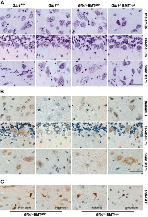 Figure 3. Morphologic analyses in the CNS of treated Glb1-/- mice. (A) Cresyl violet-stained tissue sections of the thalamus, cerebellum, and brain stem from a treated Glb1-/- mouse 3 months after transplantation (Glb1-/- BMT) and from age-matched Glb1+/+ and Glb1-/- mice that underwent mock transplantation (β-gal-/- BMTGFP) revealed restoration of tissue morphology in the treated mouse compared with the extensive vacuolation present in the mice that did not undergo transplantation (Glb1-/-) and the Glb1-/- mice that underwent mock transplantation. (B) Immunolabeling of brain stem, cerebellum, and thalamus revealed the presence of numerous β-gal+ cells in Glb1-/- mice 3 months after BMT. The clear punctate staining demonstrated internalization of the corrective enzyme. Immunolabeling with anti-GFP antibody was done in the same tissues to identify cells of hematopoietic origin. (C) Numerous GFP+ cells in various brain regions showed a ramified microglial morphology. Size bars correspond to 25 μm. Images were visualized using an Olympus BX50 microscope equipped with a 40×/0.65 Plan Apochromatic objective lens (Olympus, Melville, NY) and a Three-Shot 11.3 camera (Diagnostic Instruments, Sterling Heights, MI). Images were acquired with Spot Advanced 4.1.1 software (Diagnostic Instruments) and processed with Adobe Photoshop 8.0 software (Adobe Systems, San Jose, CA).