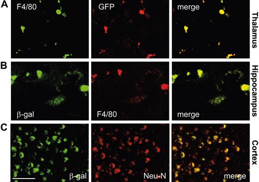 Figure 4. Identification of BM-derived vector-expressing cells in the CNS of treated Glb1-/- mice. Immunofluorescence analyses were done on single cryostatic sections from the brains of treated Glb1-/- mice. Fluorescent signals from single sections were sequentially acquired and are shown individually and after merging. (A-B) GFP+ cells and β-gal+ cells were identified as microglia by F4/80 immunoreactivity in Glb1-/- mice 3 months after BMT. (C) Overlay of β-gal staining with the neuronal-specific marker NeuN demonstrated colocalization of the 2 signals, a finding that indicates cross-correction of the enzyme-deficient neurons. Size bar corresponds to 50 μm. Image acquisition was performed as described for Figure 3.