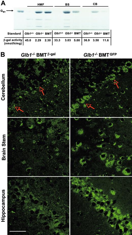 Figure 5. Attenuation of GM1-ganglioside storage in the brain caused by exogenously delivered β-gal. (A) Thin-layer chromatography of hindbrain, midbrain, and forebrain (HMF), brain stem (BS), and cerebellum (CB) of Glb1+/+, Glb1-/-, and treated Glb1-/- mice 3 months after BMT demonstrated amelioration of GM1-ganglioside storage in the brain stem and cerebellum of the treated mice. The attenuation of GM1-ganglioside accumulation was in agreement with the increment of β-gal activities in those areas (bottom row). GM1-ganglioside was used as a standard. (B) Confocal microscopy with anti-GM1 antibody confirmed less GM1 accumulation in the cerebellum, brain stem, and hippocampus of treated mice (Glb1-/- BMTβ-gal) than in Glb1-/- mice that underwent mock transplantation (Glb1-/- BMTGFP). The arrows indicate cells in which GM1-ganglioside accumulation was most arrested. Size bar corresponds to 50 μm. Image acquisition was performed as described for Figure 3.