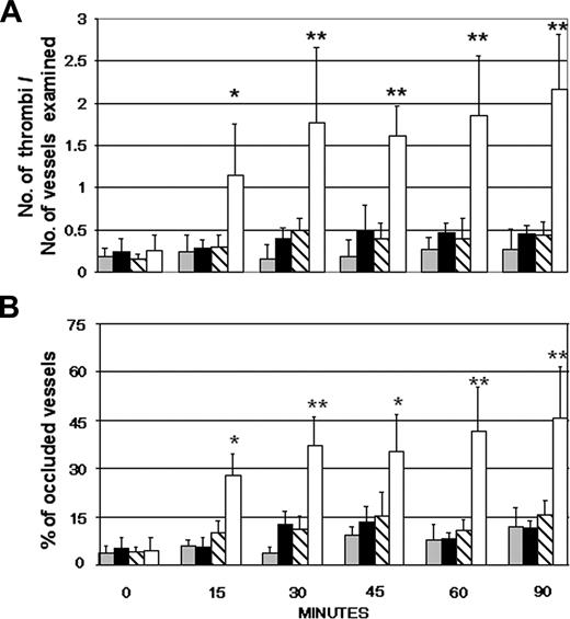 Figure 1. Effects of infusion of human aPL-positive and aPL-negative IgG in rats with or without pretreatment with LPS. Human IgG (10 mg/1 mL sterile saline) purified from 6 aPL antibody-positive sera was infused into the carotid artery of Wistar rats 3 hours after the intraperitoneally injection of either LPS (□) or sterile saline (▧). Another group of rats was treated with 5 aPL-negative IgG (10 mg/1 mL sterile saline) with (▪) or without (▦) pretreatment with LPS. The procoagulant effect of the various treatments was evaluated by counting the number of microvessels with partial or total occlusions (A) and the number of occluded vessels, as shown by the complete and persistent stop of the blood flow (B). These parameters were evaluated on 2 rats for each IgG sample to a total number of 12 and 10 rats for the aPL-positive and aPL-negative IgG, respectively. The results are expressed as mean ± SD. **P < .01, *P < .05 versus control rats receiving aPL-negative IgG.