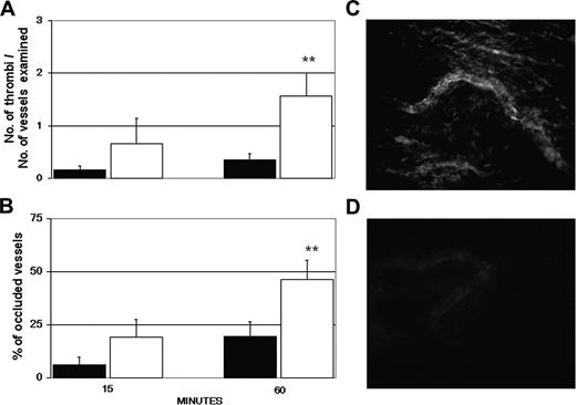 Figure 3. Antibodies to β2GPI are responsible for thrombus formation in aPL-positive IgG-treated rats. The animals received LPS and 3 hours later aPL-positive IgG (□) or anti-β2GPI-depleted aPL-positive IgG (▪) from 3 patients with APS (A, C, and D). The number of thrombi (A) and vessel occlusions (B) were evaluated at various time intervals on 4 rats per group (1 sample, D, was repeated twice), and the results are expressed as mean ± SD. **P < .01 versus anti-β2GPI-depleted aPL-positive IgG. Immunofluorescence analysis of mesenteric tissue showing deposits of IgG in rats treated with aPL-positive IgG (C) or absence of IgG in rats receiving anti-β2GPI-depleted aPL-positive IgG (D). Original magnification, × 250. Details of image acquisition are given in Dobrina et al.23