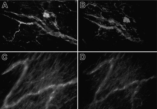 Figure 4. Localization of IgG and C components on mesenteric tissue of rats treated with LPS followed 3 hours later by aPL-positive IgG. The mesenteric tissue was double-stained for IgG (A,C) using FITC-labeled goat anti-human IgG and for C3 (B) or C9 (D) using biotin-labeled specific antibodies to rat C components (5 μg/mL) followed by RPE-conjugated streptavidin. Original magnification, × 250. Details of image acquisition are given in Dobrina et al.23