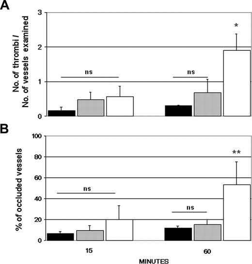 Figure 5. APL-positive IgG fail to induce thrombus formation and vessel occlusions in C6-deficient rats. Six C6+/+ PVG rats (□) and an equal number of C6-/- PVG (▦) rats received LPS and 3 hours later aPL-positive IgG from 3 patients with APS (A, C, and D). An additional group of 6 C6+/+ PVG rats (▪) received LPS followed by aPL-negative IgG. All rats were examined for the number of thrombi (A) and occluded vessels (B). Thrombi and vessel occlusions were significantly reduced in C6-/- rats. These parameters were evaluated on 2 rats for each IgG sample. The results are expressed as mean ± SD. *P < .05, **P < .01 versus C6-/- PVG receiving aPL-positive IgG; ns indicates not significant. Error bars indicate standard deviation (SD).