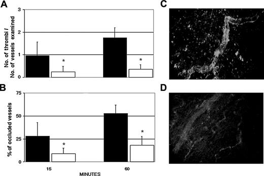 Figure 6. Effect of an anti-C5 miniantibody on thrombus formation and vessel occlusion induced by aPL-positive IgG in LPS-treated rats. The animals received 1 mg of either the anti-C5 miniantibody (□) or an unrelated miniantibody (▪) intravenously 15 minutes before the infusion of aPL-positive IgG (10 mg/1 mL sterile saline). The IgG from 3 patients with APS (A, C, and D) and from 3 healthy control subjects were used. In parallel experiments the miniantibody used at this concentration was found to completely neutralize the serum C activity for 20 minutes and to maintain this activity to 50% of the starting value up to 5 hours after infusion (data not shown). Thrombi (A) and vessel occlusions (B) were significantly reduced in the rats treated with the miniantibody to C5. These parameters were evaluated on 2 rats from each IgG sample. The results are expressed as mean ± SD. *P < .05 versus control rats receiving the unrelated miniantibody. Immunofluorescence analysis of the mesenteric tissue from LPS-treated rats that received aPL-positive IgG and anti-C5 miniantibody showing the deposits of C3 (C) and absence of C9 (D). Original magnification, × 250. Details of image acquisition are given in Dobrina et al.23