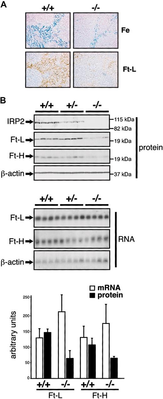 Figure 5. Diminished iron staining and ferritin expression in the spleen of IRP2-deficient mice. (A) The spleen from 10-week +/+ and -/- males was analyzed by Prussian Blue staining (top panels) or staining with an anti-ferritin L-chain antibody (bottom panels). Prussian blue coloration was counterstained with Nuclear Fast Red and ferritin immunostaining with hematoxylin. Pictures were acquired on a Axiophot microscope (Zeiss) with a × 20 objective. Ferritin H-chain expression was below the detection limit and is not shown. (B) IRP2 and ferritin H- and L-chain expression was analyzed in groups of 4 +/+, +/-, and -/- mice by Western (top panels) and Northern (bottom panels) blotting from 40 μg total protein or 10 μg total RNA, respectively, using β-actin as a standard. The histogram represents the level of ferritin expression after normalization for β-actin. Error bars indicate standard deviation.