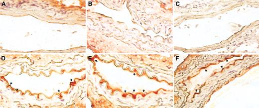 Figure 4. In vivo engraftment capacity of CD14+/VEGFR-2+ and CD14+/VEGFR-2- cells. Immunohistochemical staining of sections from balloon-injured mouse femoral artery with an anti-GFP antibody showed (A) no localization of GFP+ areas in sham-transplanted and (B) CD14+/VEGFR-2--transplanted cells on the luminal surface of the seeded artery. (C) Staining with control secondary antibody. (D) Significant number of GFP+ (red) CD14+/VEGFR-2+ cells (arrows) at 2 weeks and (E-F) 4 weeks were found in the animals that received these cells. Original magnification, 60 ×.