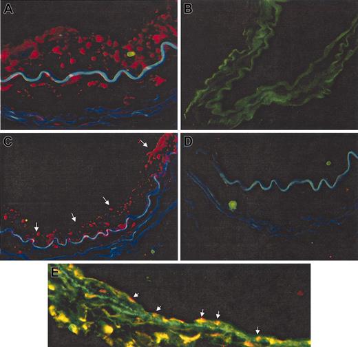Figure 5. Immunofluorescence staining for detection of CD14+/VEGFR-2+ and CD14+/VEGFR-2- cells after transplantation. Human nucleus antibody stained cells (red) in normal human artery (A) but not in control-injured, sham-transplanted mouse artery (B). (C) Balloon-injured mouse femoral artery showed the localization of transplanted human CD14+/VEGFR-2+ cells on the luminal surface of the seeded artery (red cells, arrows) at 4 weeks. (D) No localization of transplanted CD14+/VEGFR-2- cells was observed at 4 weeks. (E) The endothelial cell phenotype of transplanted human cells was confirmed by double staining with human nucleus antibody and antibodies to VE-cadherin (double-positive cells are stained yellow; arrows). Original magnification, 60 ×.