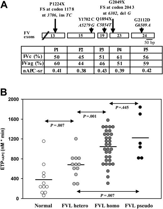 Figure 1. FV gene mutations and hemostatic parameters in FV Leiden pseudohomozygotes. (A) Top: F5 gene mutations preventing the expression of the non-Leiden FV allele in pseudohomozygous probands P1-P5. Italics, nucleotide changes; FS, frame shift; X, stop codon. Amino acid changes are indicated with the one-letter code. The large exon 13 is not drawn to scale. Bottom: FV activity (FVc) and antigen (FVag) levels (normal range, 80%-120%) and normalized APC sensitivity ratio (nAPC-sr). APC resistance is defined by an APC-sr less than 0.84; nAPCsr range of FV Leiden homozygotes 0.35 to 0.45. Mutations and patients are aligned. (B) Distribution of the endogenous thrombin potential (ETP) determined in the presence of APC in individuals with normal FV genotype (n = 11), FV Leiden heterozygotes (n = 12), FV Leiden homozygotes (n = 32), and FV Leiden pseudohomozygotes (n = 6). Genotype groups were compared with the Mann-Whitney Wilcoxon test. The horizontal lines indicate the means in the respective genotype groups. FVL stands for Factor V Leiden.